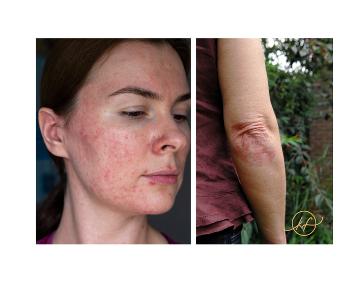 What is your skin is trying to tell you?